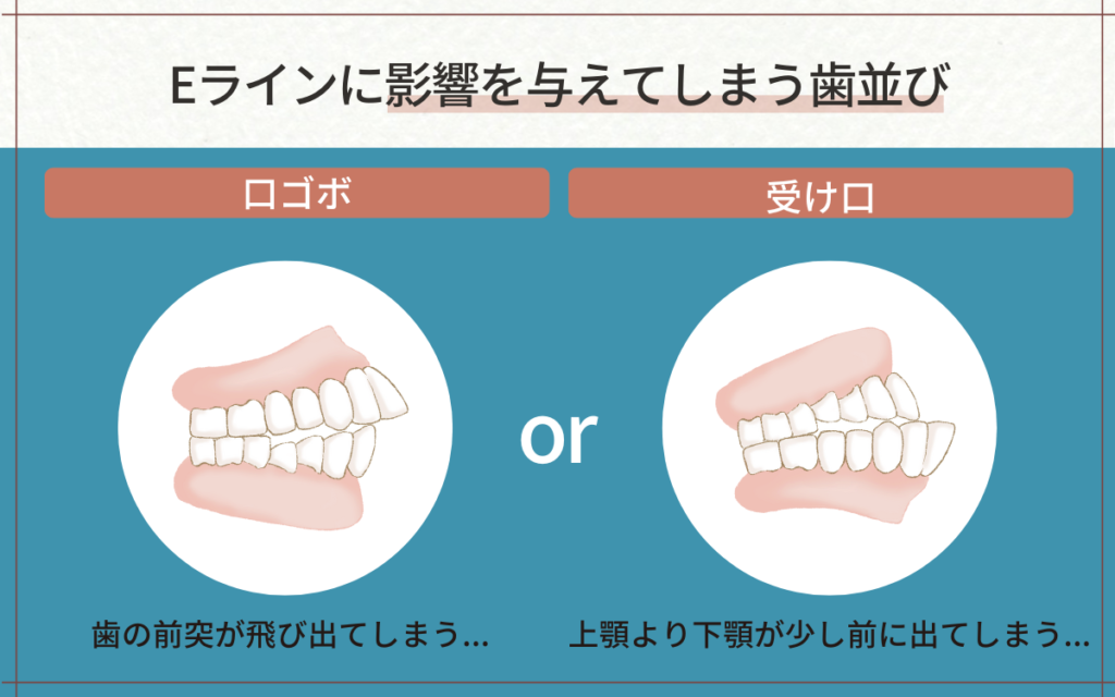 横顔のEラインに影響を与えてしまう歯並び